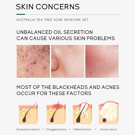 INBOLM Skin Care Sets for Womens