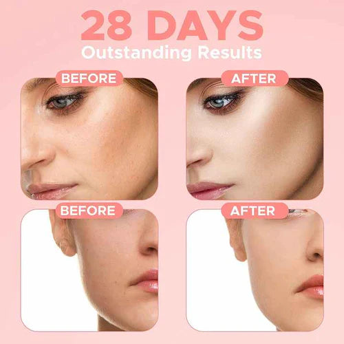 4 in 1 Whitening Anti Age Face Serum